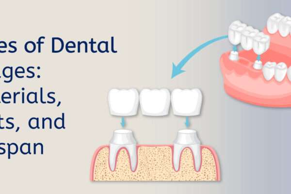 Types-of-Dental-Bridges-Materials,-Costs,-and-Lifespan