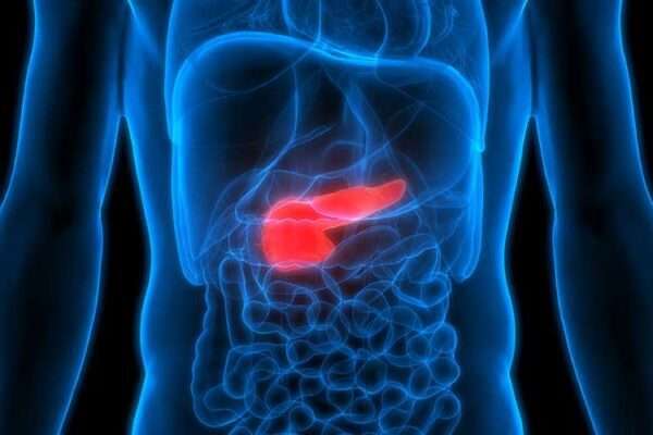 pancreatic pseudocyst treatment