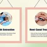 root canal