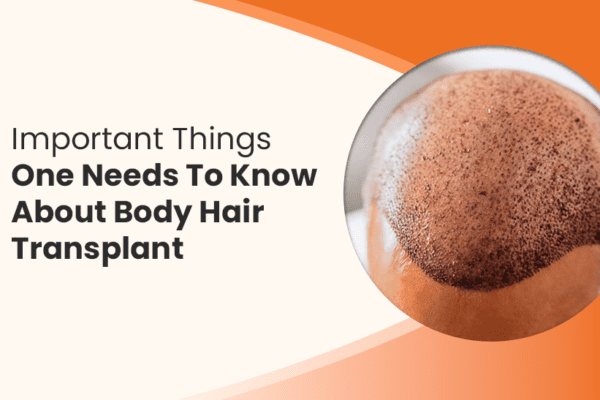 Body Hair Transplant