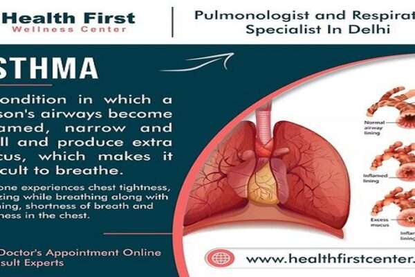 best asthma doctor in delhi