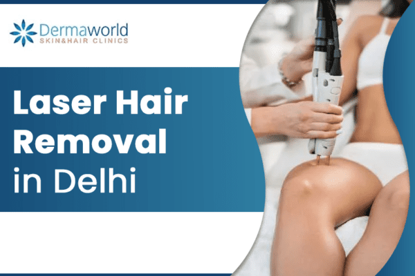 laser hair removal in delhi