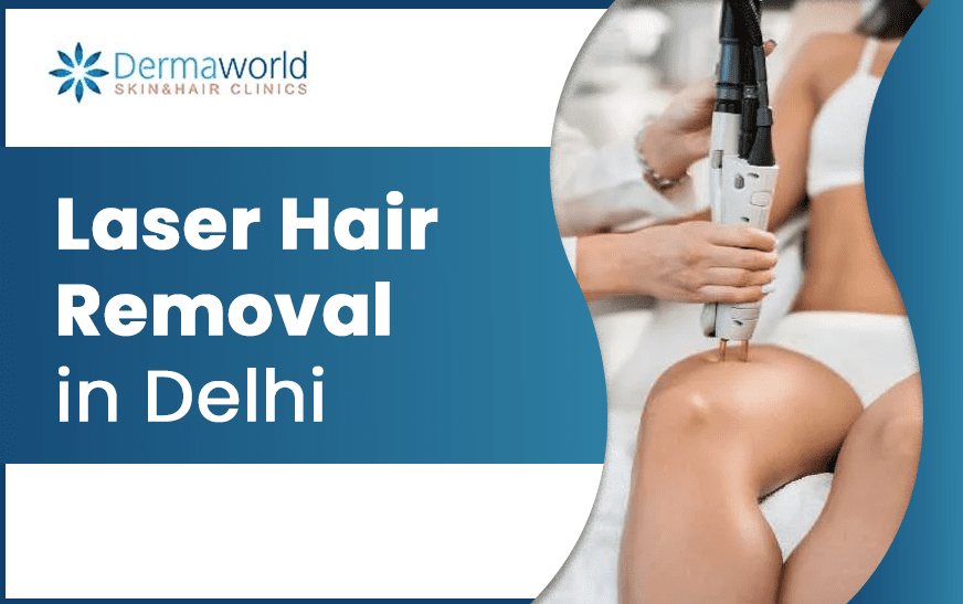 laser hair removal in delhi