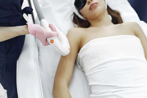 facial laser hair removal