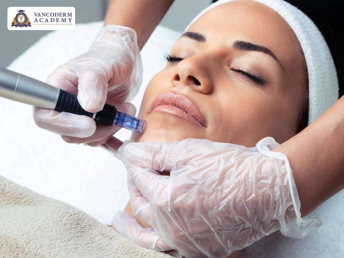 microneedling training