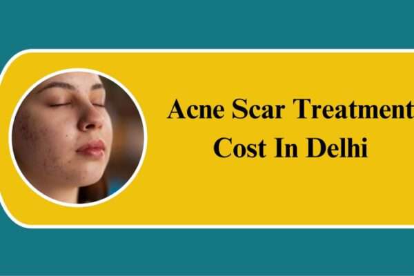 acne scar treatment