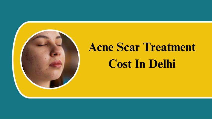 acne scar treatment