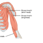 biceps tendinopathy