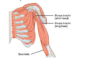 biceps tendinopathy