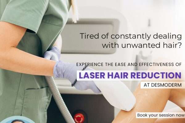 laser hair removal treatment