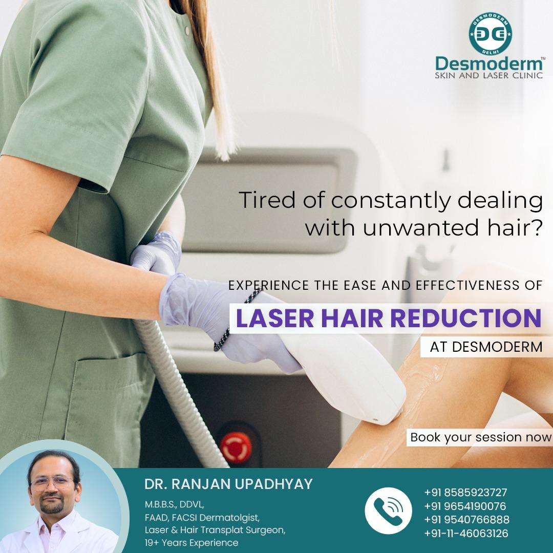 laser hair removal treatment