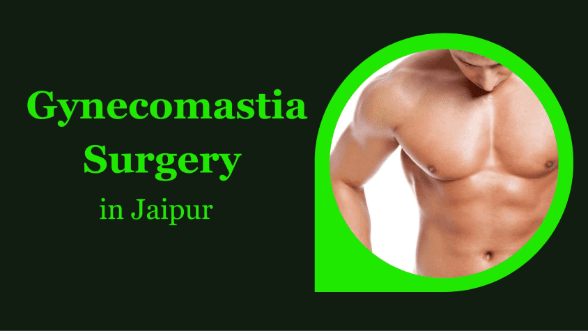 signs of gynecomastia